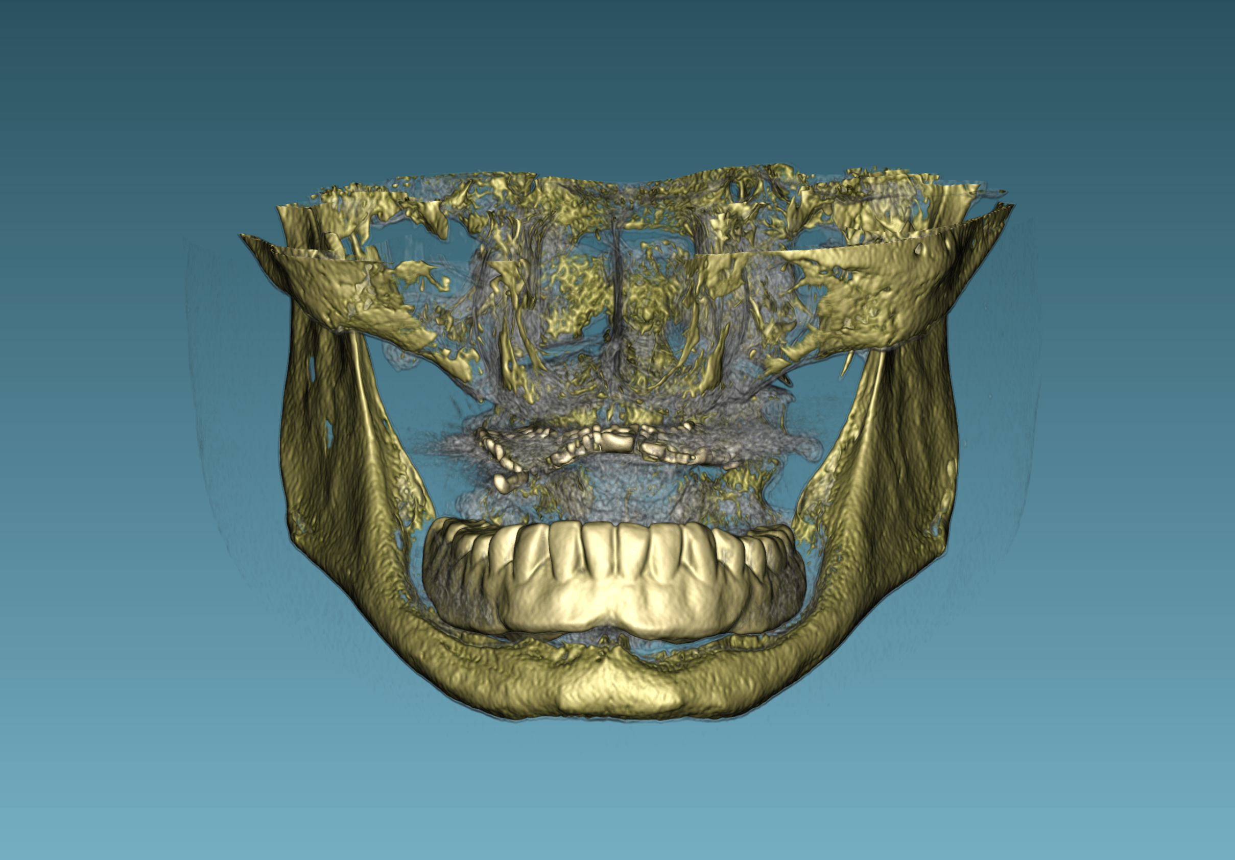 3D